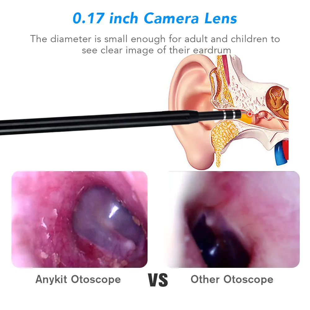 Visible Earpick Medical Otoscope Waterproof Camera Earwax Visual Oral Inspection Ear Spoon Support Android PC Ear Cleaning To